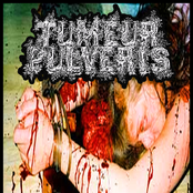 LETHAL TUBERCULAR PLEURITIS UROMPULMONARY