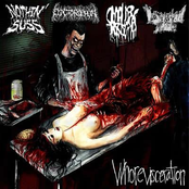 Whorevisceration (4-Way Split)