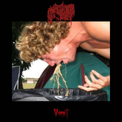 Vomit