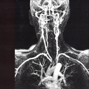 a história do fluxo sanguíneo