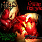 Unorthodox Methods to Resect an Aggressive Rectal Carcinoma