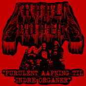 Purulent Aapning Til Indre Organer