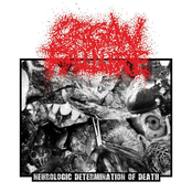 Neurologic Determination