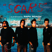 Scars