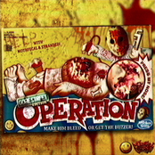 OPERATION