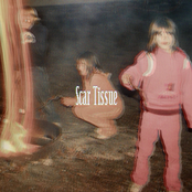 Scar Tissue