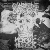 Mononuchleosis / Gangrene Discharge