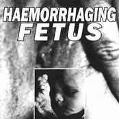 Procreation: A Disease