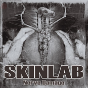 Skinlab: Nerve Damage (New & Rarities)