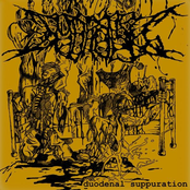 Duodenal Suppuration