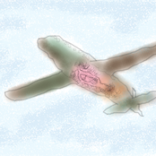 Íåäîáðîæåëàòåëüíîå Îíàíèðîâàíè