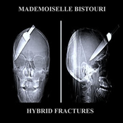 Hybrid Fractures