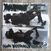 Human Spontaneous Combustion