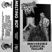 Melting Rot: Irreversible Surgical Failure