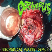 Biomedical Waste