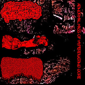 ABNORMAL MASS OF HYPERBLASTING GORE (3 Way split w Lymphoedema and MYCOSIS)