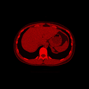 Bodies that have not found their place