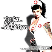 Abnormalitas Parafilia