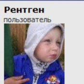 Рентген