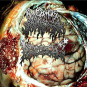 Blenorrhagical Spermatocystitis / Dread Cunt split