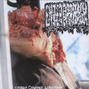 Crash-Course Lobotomy