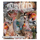 Hypertrophic Excrescence