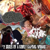 2 Sides Of A Gorey Gaping Wound