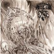 Severance (Dead To This World)