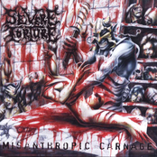Your Blood Is Mine by Severe Torture
