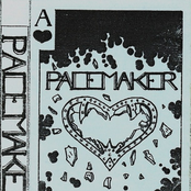 pacemaker