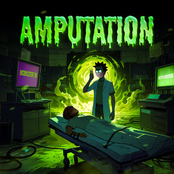 Amputation