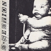 Sweet Spine: C-Section