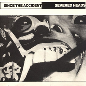 Golden Boy by Severed Heads