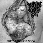Putrid Gastric Gore