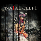 natal cleft