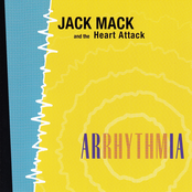 Arrhythmia