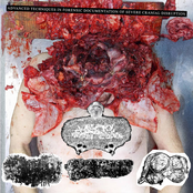 Advanced Techniques in Forensic Documentation of Severe Cranial Disruption