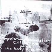 The Amputation Appreciation Collective Sings the Body Electric