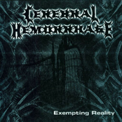 Cerebral Hemorrhage