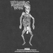 The Relation Between Patterns of Vomiting and Psychiatric Diagnoses