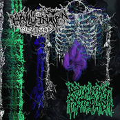 Redundant Protoplasm Split