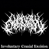 Involuntary Cranial Excision (Split)