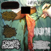 6 Way Anus Organ Removal