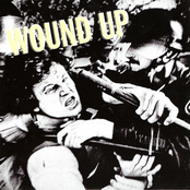 Wound Up