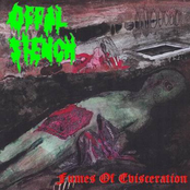 Fumes Of Evisceration [Re-Issue]