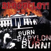 Burn Babylon Burn