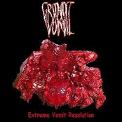 Extreme Vomit Resolution