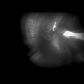 Atlético Nasa / Dos Vidas