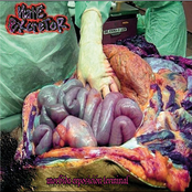 Mórbida Exposición Terminal