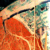 Gamma Knife: Gamma Knife Demos